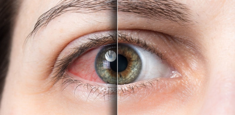 Eye Drops - Rooyati