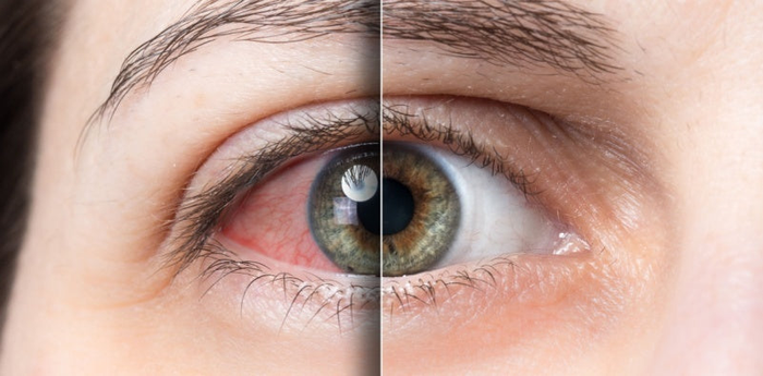 Eye Drops - Rooyati